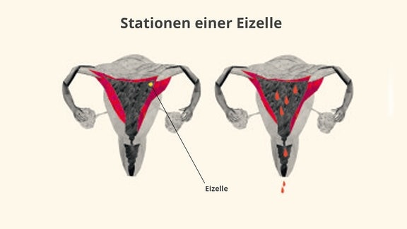 Eizelle in der Gebärmutter und anschließend einsetzende Blutung